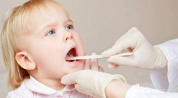 Çocuklarda Bademcik Belirtileri ve Tedavisi